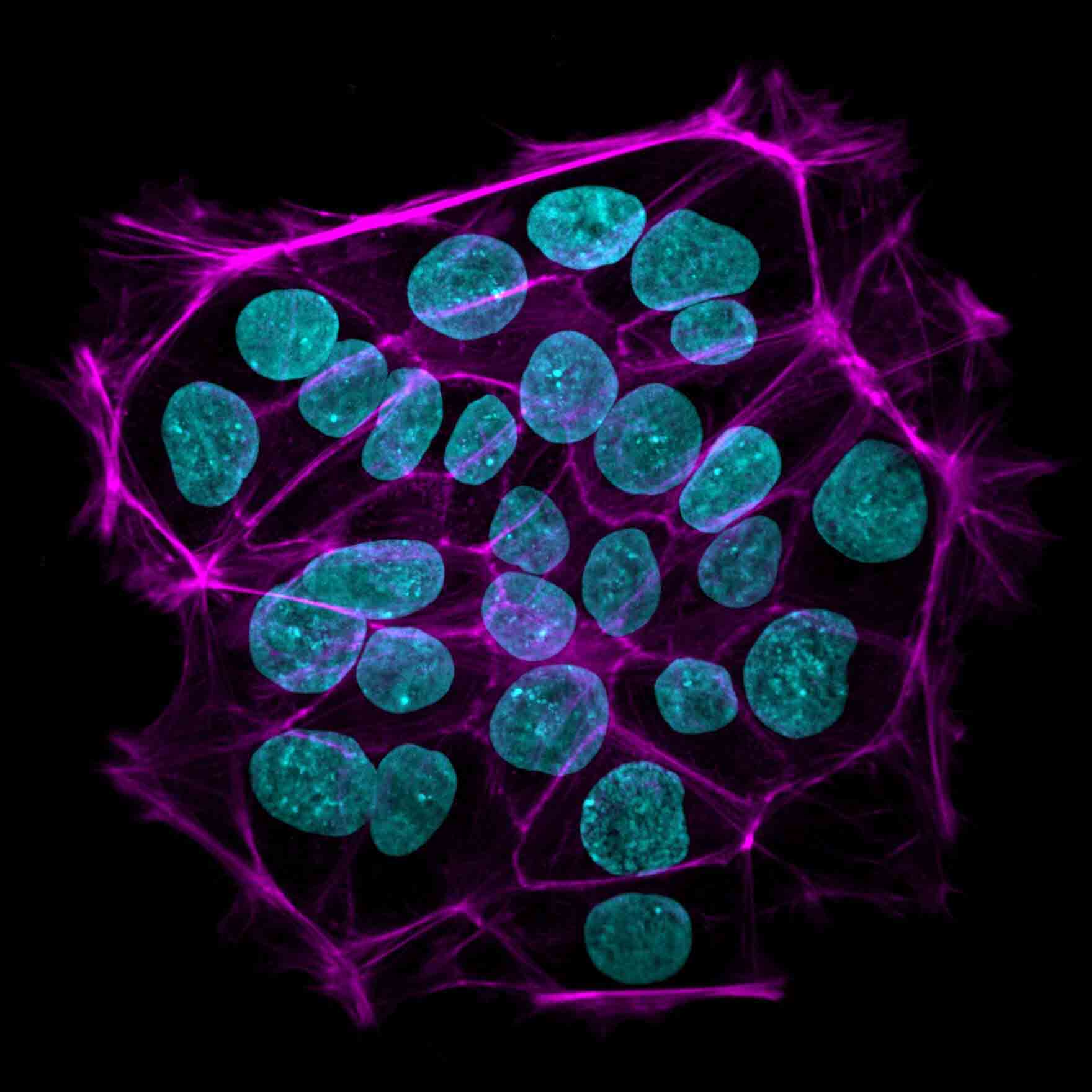 Cellular Adhesion and the Extracellular Matrix