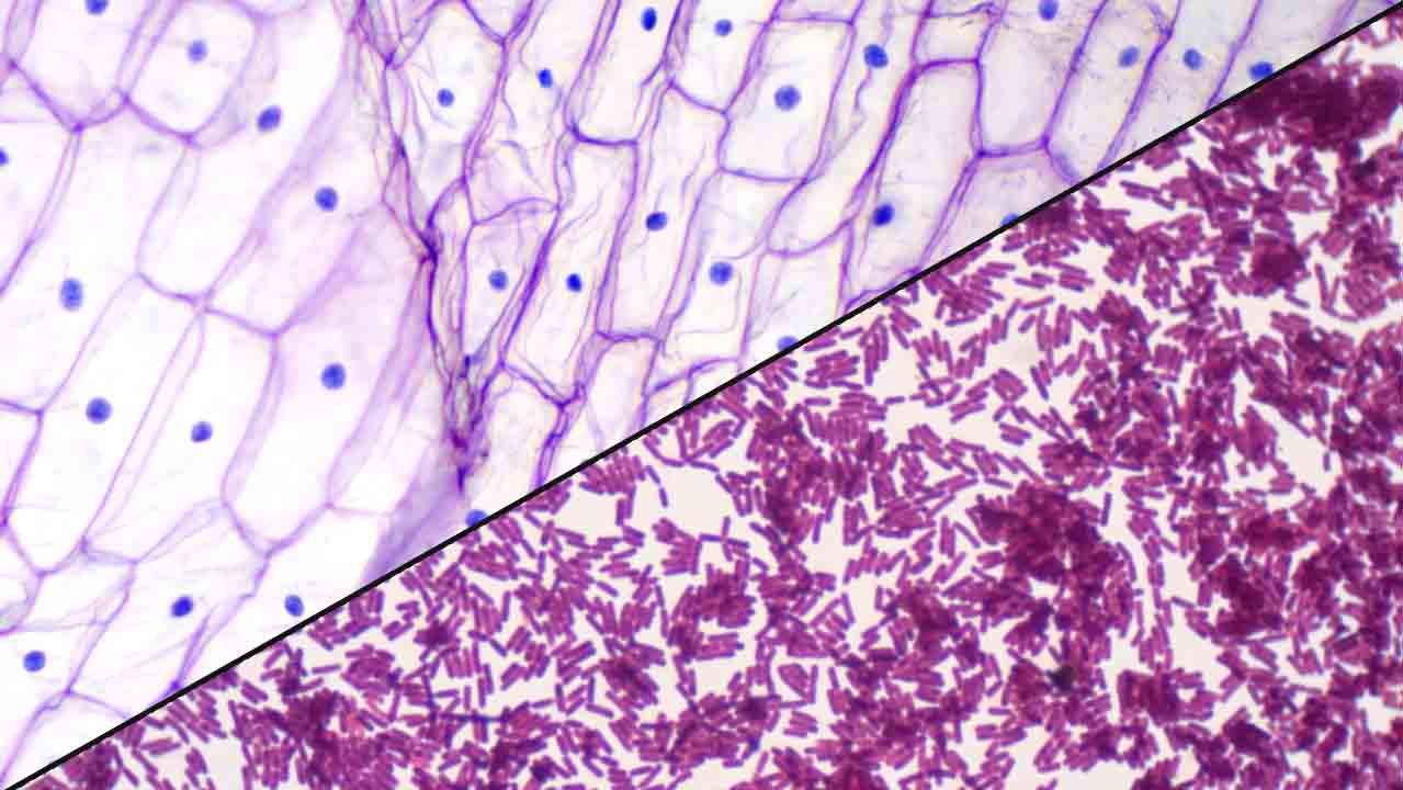 Prokaryotic and Eukaryotic Chromosome Structure