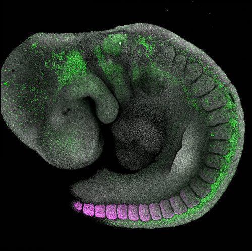 Developmental Biology - Gametogenesis, Spermatogenesis, Oogenesis, Fertilization 