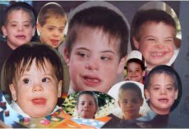 Mental Retardation – Its Multidisciplinary Aspect