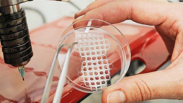 Tissue Engineering
