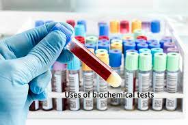 Biochemical Characteristics