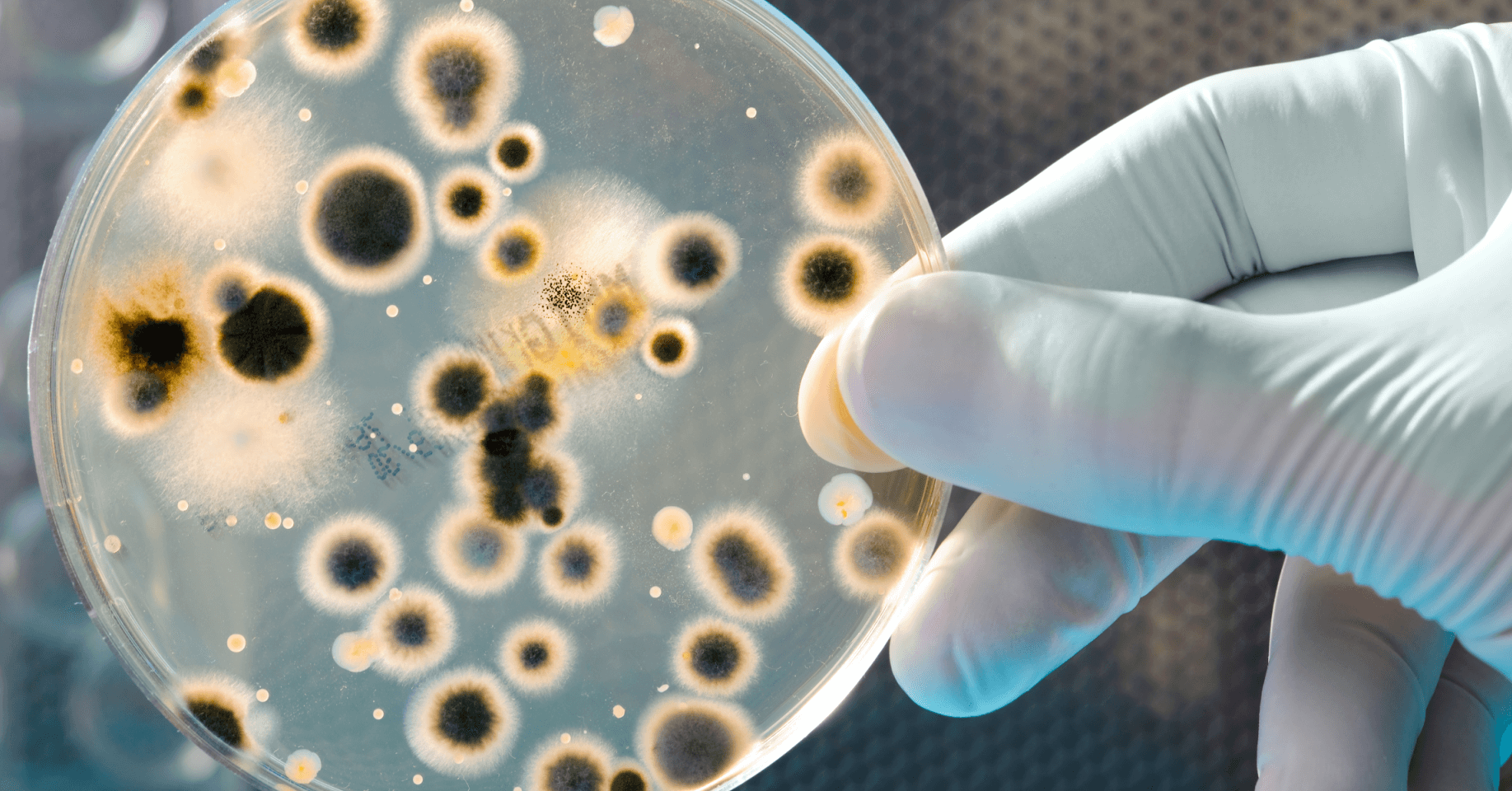 Microbial Growth
