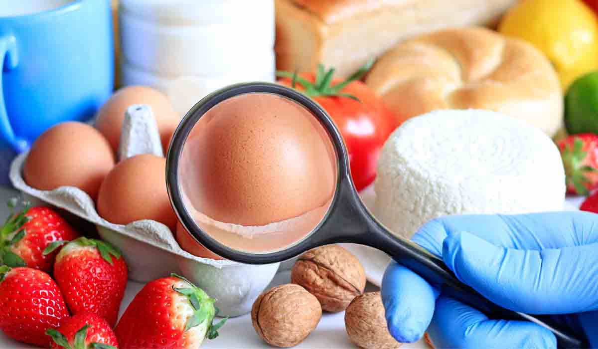 Food Regulation and Safety