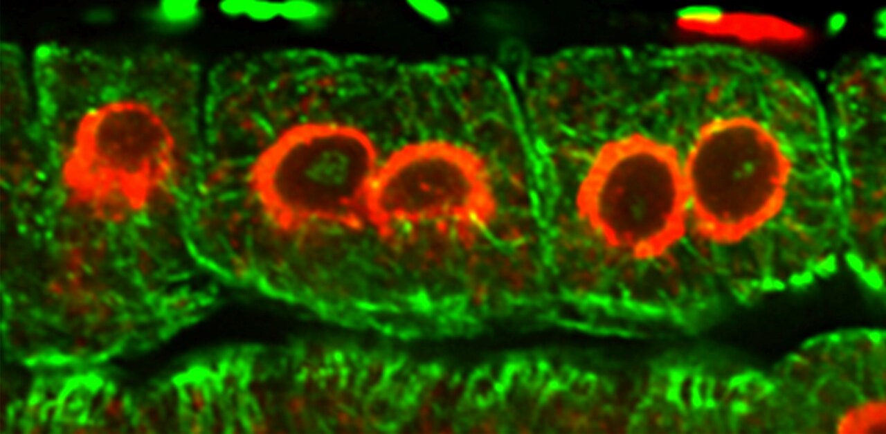Cell Division in Plants